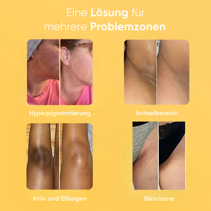 Zitronen-Kurkuma- & Kojinsäure-Aufhellungsseife