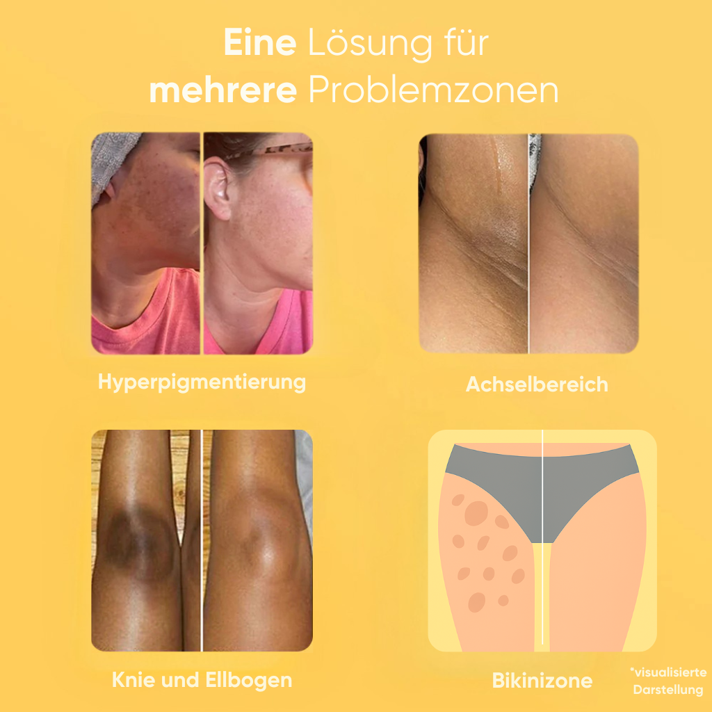 Zitronen-Kurkuma- & Kojinsäure-Aufhellungsseife